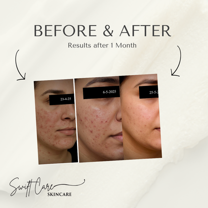 Swift Care Hypochlorous Acid Spray