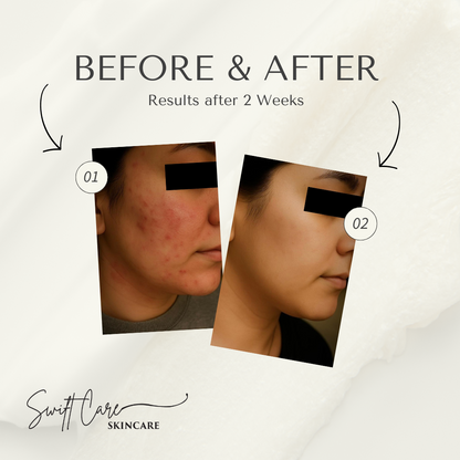 Swift Care Hypochlorous Acid Spray